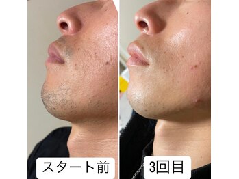 クレエ(Cre’er)/メンズメニューも☆