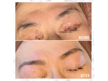 キセキ(KISEKI)/ブロウマッピング