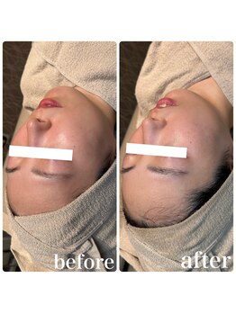 ディオーネ 春日井勝川店(Dione)/マーメイドセルトリートメント