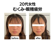 マーキュリー(Mercury)/美容鍼灸のお客様