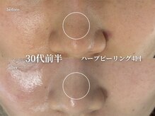 コウル 川西能勢口店(geoul)/透明感アップコース