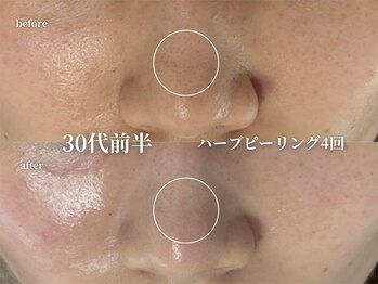 コウル 川西能勢口店(geoul)/透明感アップコース