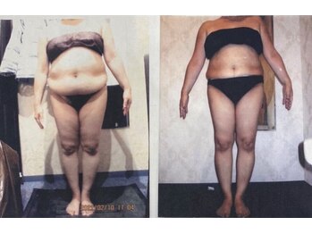 クイーン 神戸三宮店(Queen)/お客様　ビフォーアフター（3）