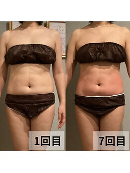 セイリキ(SEIRIKI)/★痩身ダイエットお客様のお声★