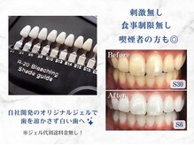 ホワイトニングショップ 豊田店(WHITENING SHOP)