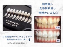 ホワイトニングショップ 豊田店(WHITENING SHOP)
