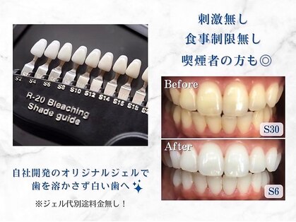 ホワイトニングショップ 豊田店(WHITENING SHOP)の写真