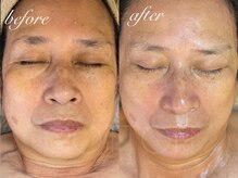 プライベートサロン コットン(COTTON)/オーダーメイド幹細胞プラズマ