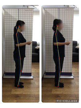 ボディメイク整体院 横浜駅西口店(BodyMake)/施術風景-反り腰改善希望の女性-