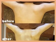 モルティープリマクラッセ 宇都宮東店(Molti Prima Classe)/ボディケア