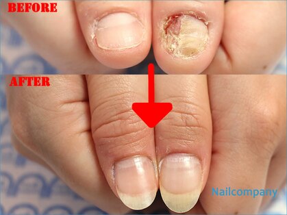 ネイルカンパニーの写真