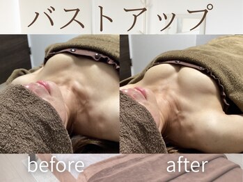 ラグレ(LUXRE)/バストケア