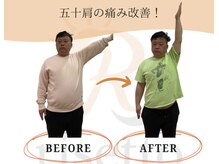 リセット鍼灸院(Risetto鍼灸院)/五十肩で悩んでいないですか？