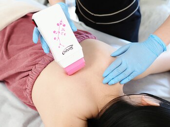 レッド(RED)/背中ワックス脱毛