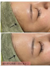 スウィート 矢場町店(Sweet)/【顔脱毛】