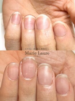 マリーロール 梅田店(Marie Laure)/自爪育成/深爪矯正/ネイルケア