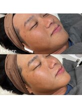 ニーナアイプラス(nina eye+)/マリムーブフェイシャルワックス