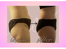 ヨサパーク ハーブ Melody亀山店(YOSA PARK)/2回目から７回目の変化