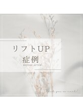 美バリ 新宿店(美BARI)/エアバリ/ハイドラ/EMS/光フォト