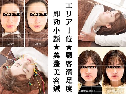 ダズル(DAZZLE)の写真