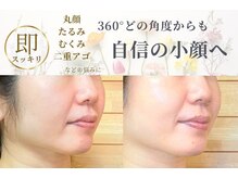 ハナハナ(hanahana)