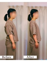 ユルビノ 武蔵小杉(yurubino)/Y様／会社員／20代女性