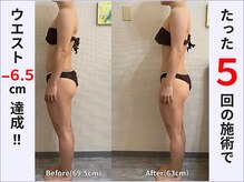 ぷりんす整体コージー(COZY)/【30代 女性】ビフォーアフター