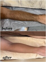 ロジュマンアンドクレア(LOGEMENT&Crea.)/全身脱毛