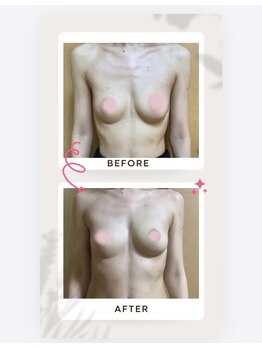 アップオー 小倉店(up・O)/体験者様、施術例