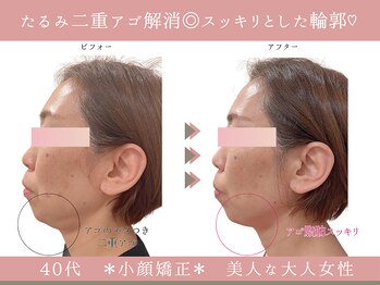 グレースエール トータルビューティーサロン(Grace Aile)/*小顔矯正*