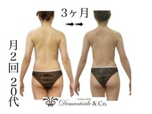 デマントイド 倉敷(Demantoide&Co)/大人気スキャルプ