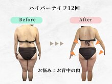 美容整体ウェリナ あま甚目寺院/.【ダイエットbefore→after】