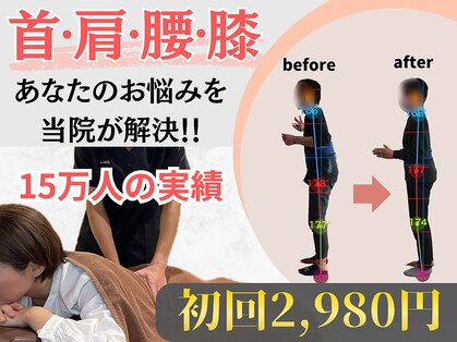 アテオスの写真