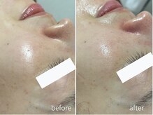 サロン ウル(salon Uru.)/潤い爆弾