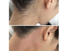 サロンエム 西荻窪(salon M)の雰囲気(うなじは女性に人気のメニューです、ワックスですぐにきれい♪)