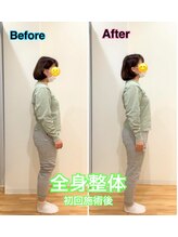 スカイ 鍼灸整骨院 整体院(SKY)/全身美容整体