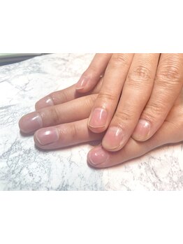 爪の悩みを解消できる（ケア含む）