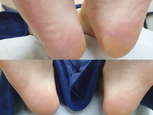 リゼラアンドコー 浦安店/ドイツ式フットケア専門店