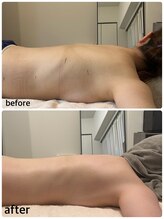 ラピスラズリ/ポールシェリー2回[痩身エステ]