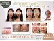 シェリー(Cherie)の写真