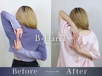 ビーハリット(B-HariT)/Before/After【六本木】
