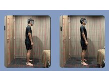 あたまラボ/国家資格保有者　猫背矯正