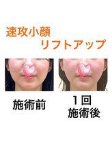 鍼灸サロンオランジュ 高槻富田院/