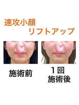 鍼灸サロンオランジュ 高槻富田院/