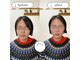ハリボケア 葛西(haribo care)の写真