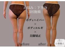 小顔職人の雰囲気（ボディもやってます）