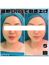 アンドワイ バイ サロンリーナ(&y by Salon Lena)/【最強リフトアップコース】