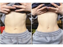 レガリス(REGALIS)/before/after くびれ