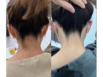 ミース 江坂店/うなじ●ビフォーアフター