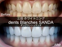 ダンブランシュサンダ(dents Blanches SANDA)/三田でホワイトニングするなら